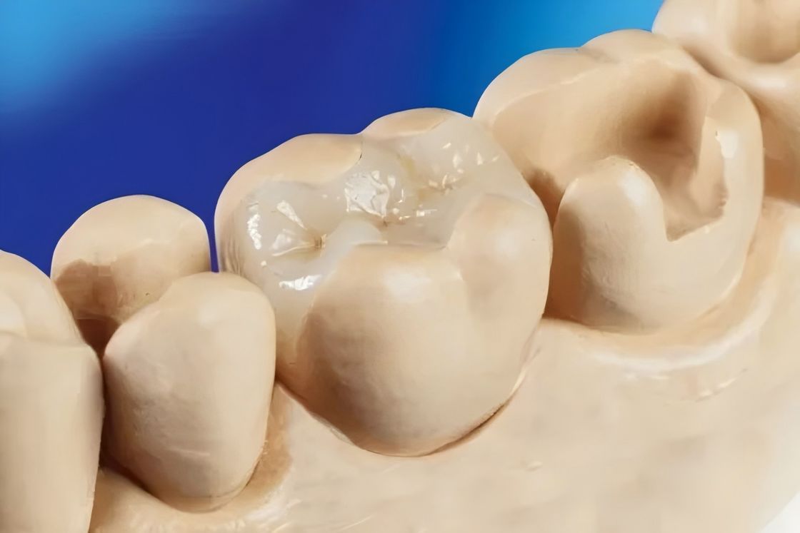 Audental Dental Lab Materiały Ceramiczne Szklane Blok Cyrkonu Blok Dwukrzemianu Litowego Sztabka do Odbudowy Dentystycznej